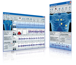 Zargis Cardioscan Software